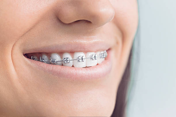 Best Teeth Whitening  in Etowah, TN